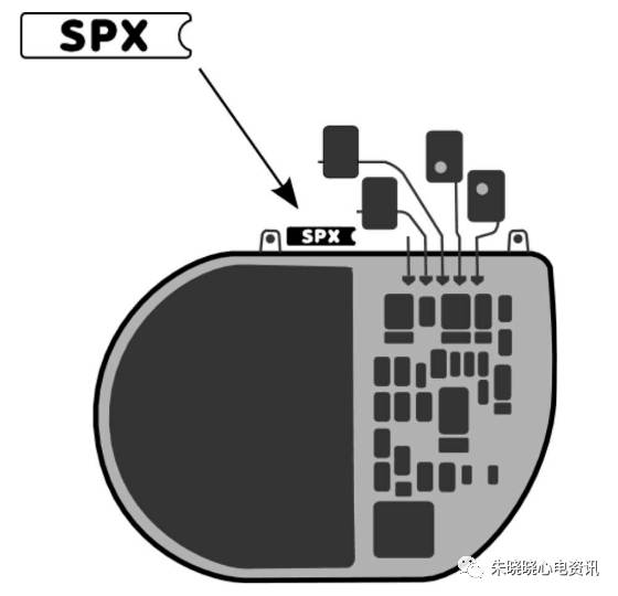 百多力起搏器怎么样通过胸片识别起搏器的简易三步法_https://www.jmylbn.com_新闻资讯_第5张