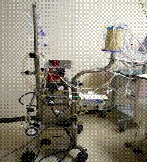 什么是气体陷闭ECMO的裝置与准备_https://www.jmylbn.com_新闻资讯_第17张