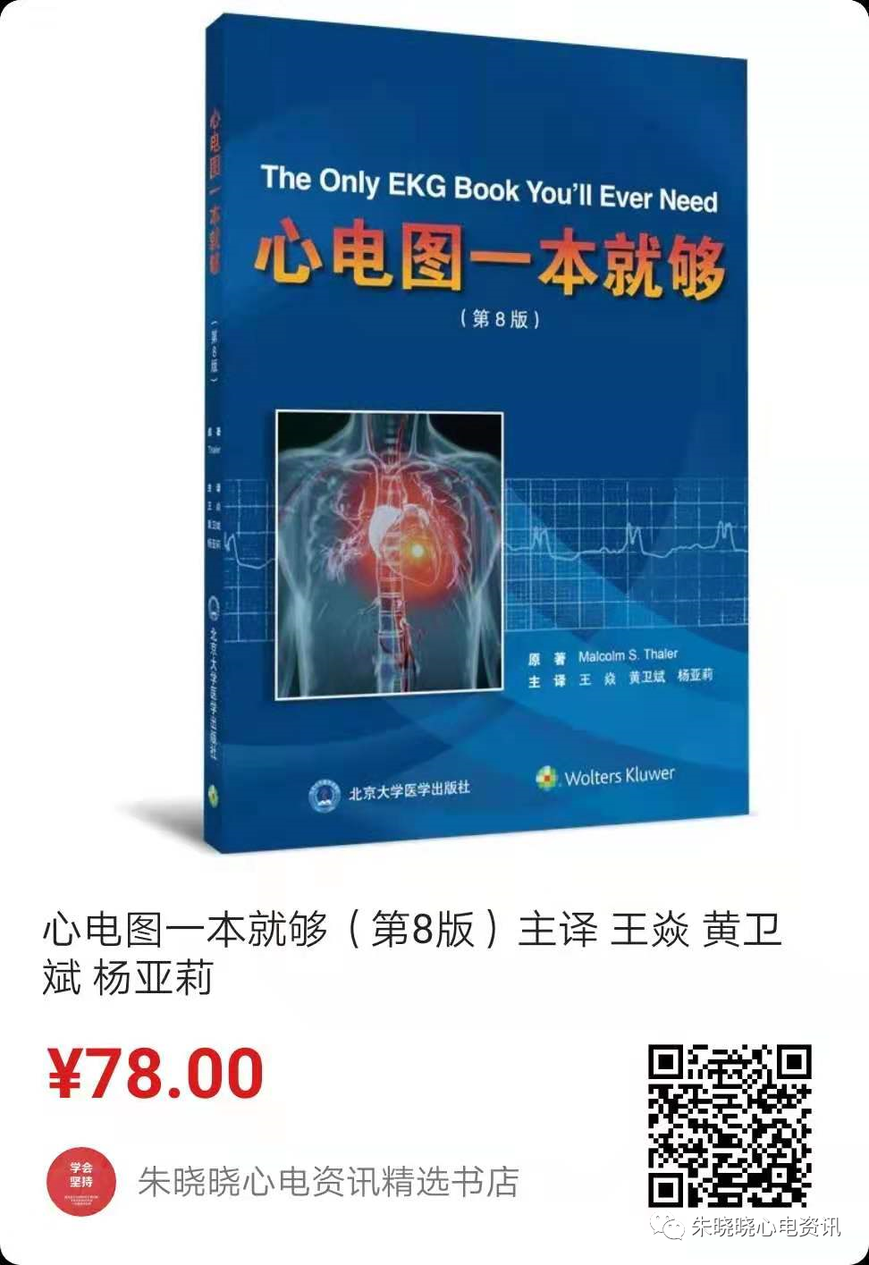 心电图怎么切换导联临床实用心电图入门系列之二：心电图导联、波形及临床价值_https://www.jmylbn.com_新闻资讯_第25张