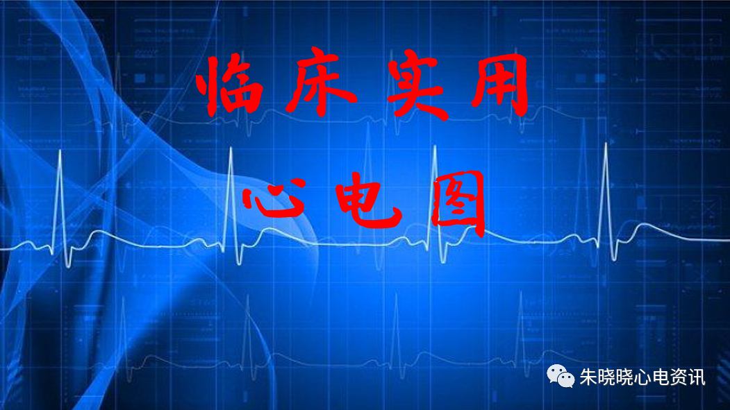 心电图怎么切换导联临床实用心电图入门系列之二：心电图导联、波形及临床价值_https://www.jmylbn.com_新闻资讯_第3张