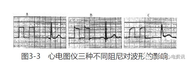 心电图纸怎么看【临床实用心电图入门】第三讲：心电图的测量要点_https://www.jmylbn.com_新闻资讯_第4张