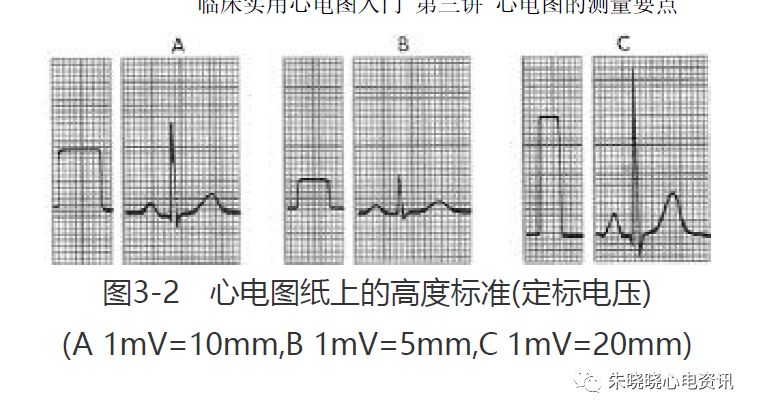 心电图纸怎么看【临床实用心电图入门】第三讲：心电图的测量要点_https://www.jmylbn.com_新闻资讯_第3张