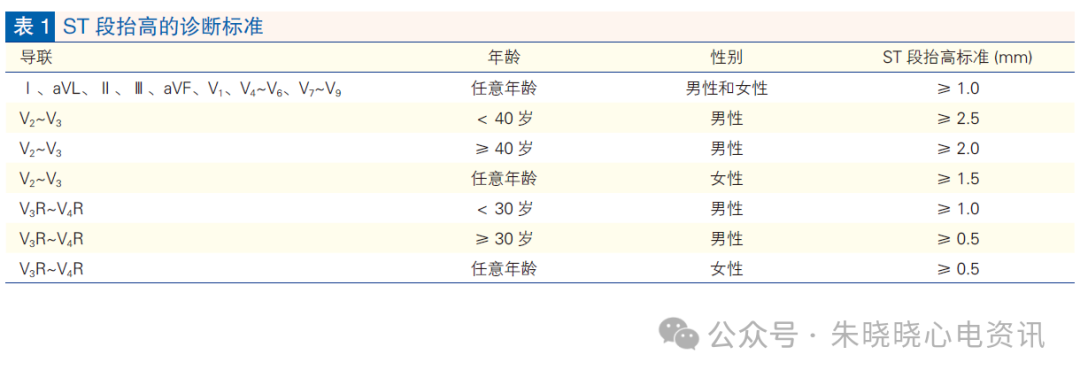 心肌梗死心电图诊断标准和报告规范中国专家共识