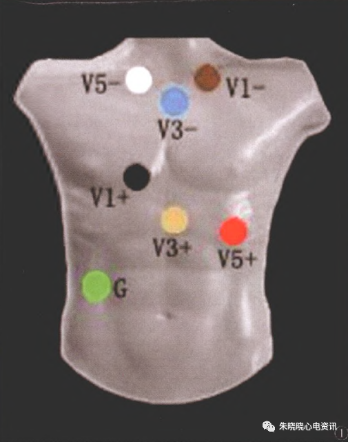 怎么装动态心电图动态心电图标准化临床操作方法，你掌握了吗？_https://www.jmylbn.com_新闻资讯_第7张
