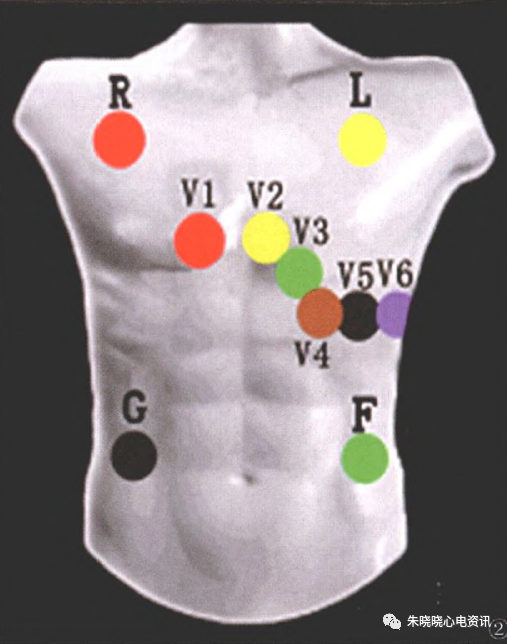怎么装动态心电图动态心电图标准化临床操作方法，你掌握了吗？_https://www.jmylbn.com_新闻资讯_第8张