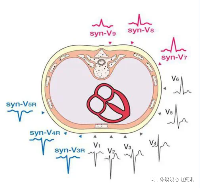 心电图12导怎么组成从12导联到18 导联，你以为只是数字的改变吗？不，这其实更是一场技术的革新！_https://www.jmylbn.com_新闻资讯_第7张