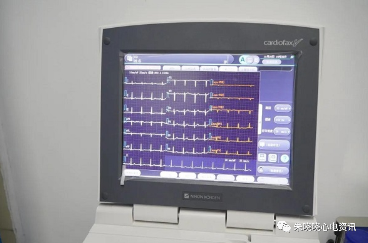 心电图12导怎么组成从12导联到18 导联，你以为只是数字的改变吗？不，这其实更是一场技术的革新！_https://www.jmylbn.com_新闻资讯_第3张