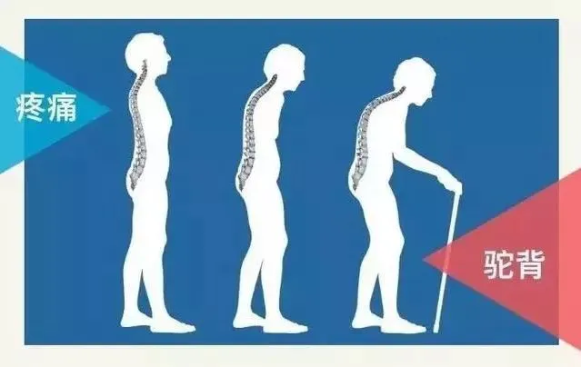 双能x骨密度检测仪为什么非得输入体重身高骨密度检测公认的“金标准”——双能X线骨密度检测正式上线啦！_https://www.jmylbn.com_新闻资讯_第3张