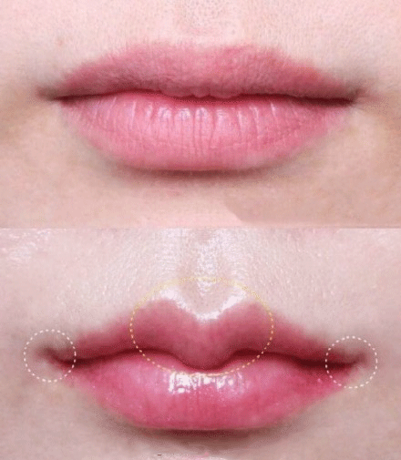 姑娘丰了唇珠你才知道你有多性感