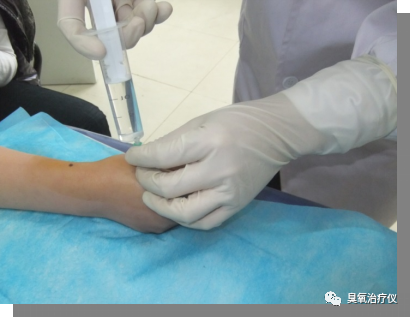 医用臭氧有什么作用医用臭氧水注射治疗之临床应用_https://www.jmylbn.com_新闻资讯_第2张