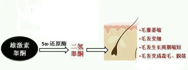 为什么先做毛囊检测？来看看你的脱发用不用治，能不能治