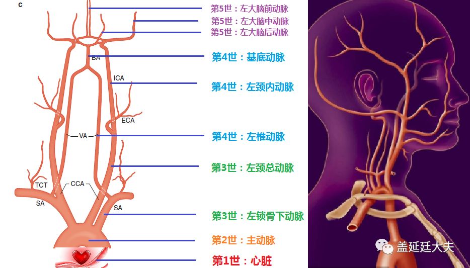 dr盖延廷脑动脉血管的家谱