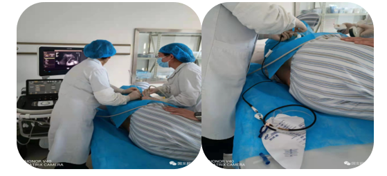 logiq e怎么读超声影像 ｜ 国文医院引进GE LOGIQ E11全“芯”高端全身超声_https://www.jmylbn.com_新闻资讯_第13张