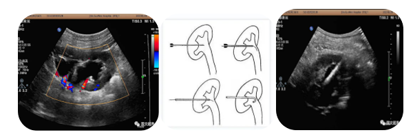 logiq e怎么读超声影像 ｜ 国文医院引进GE LOGIQ E11全“芯”高端全身超声_https://www.jmylbn.com_新闻资讯_第15张