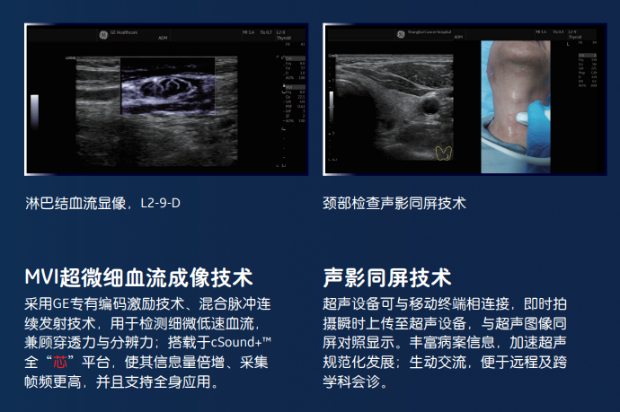 logiq e怎么读超声影像 ｜ 国文医院引进GE LOGIQ E11全“芯”高端全身超声_https://www.jmylbn.com_新闻资讯_第25张
