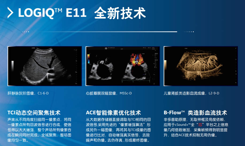 logiq e怎么读超声影像 ｜ 国文医院引进GE LOGIQ E11全“芯”高端全身超声_https://www.jmylbn.com_新闻资讯_第24张