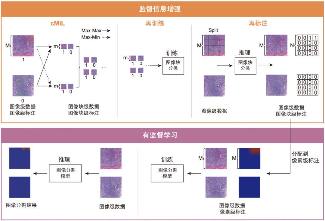 2019 ICCV收錄論文：基於弱監督學習的病理影像分析框架