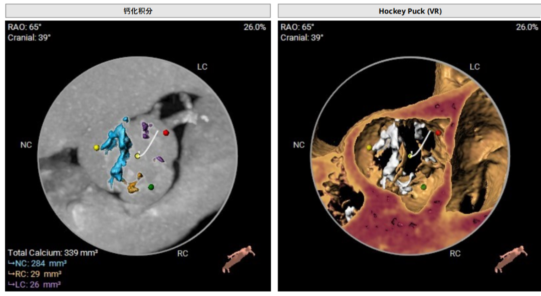 安贞医院挂号CT加急-安贞医院petct预约 