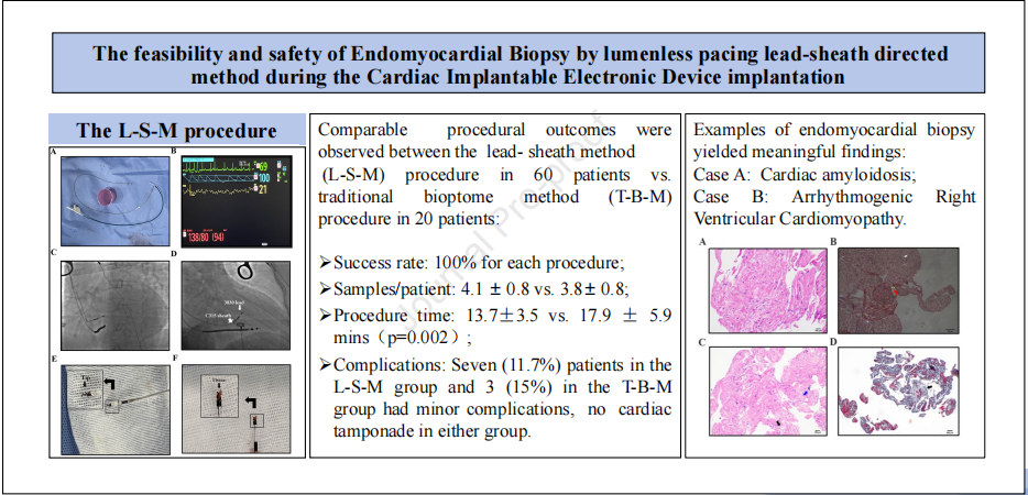 血管鞘组是什么傅国胜／叶炀教授团队创新技术发表《Heart Rhythm》：无钢丝引导电极-鞘介导心肌活检术在CIEDS植入期间可行、安全_https://www.jmylbn.com_新闻资讯_第3张