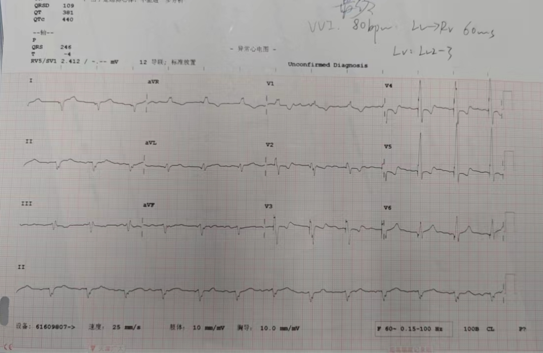 消融电极医院怎么收费节律重整 收获心生｜北京大学第一医院心内科团队率先使用左室主动电极行房室结消融+LOT-CRT一站式手术_https://www.jmylbn.com_新闻资讯_第4张