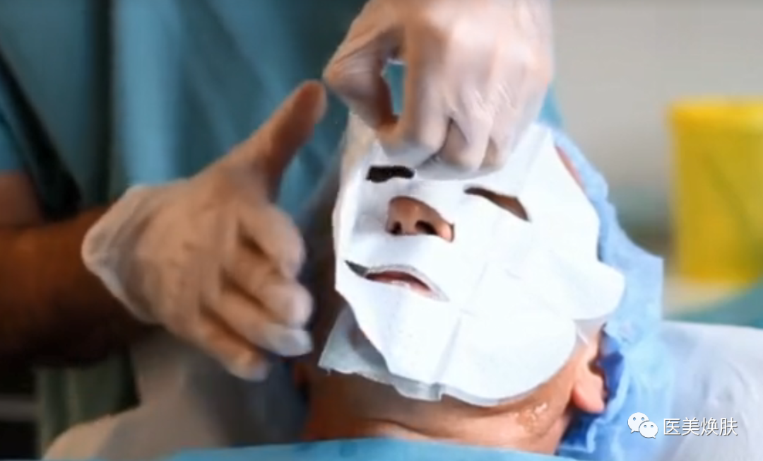 怎么消毒滚针滚针操作的方法及注意事项_https://www.jmylbn.com_新闻资讯_第5张