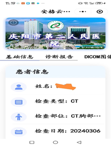 为什么x光片用胶片“云胶片”正式上线啦——用手机随时随地就能看X光片、CT、核磁共振_https://www.jmylbn.com_新闻资讯_第11张