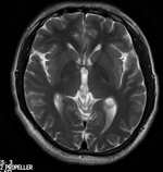 为什么x光片用胶片“云胶片”正式上线啦——用手机随时随地就能看X光片、CT、核磁共振_https://www.jmylbn.com_新闻资讯_第5张