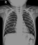 为什么x光片用胶片“云胶片”正式上线啦——用手机随时随地就能看X光片、CT、核磁共振_https://www.jmylbn.com_新闻资讯_第2张