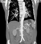 为什么x光片用胶片“云胶片”正式上线啦——用手机随时随地就能看X光片、CT、核磁共振_https://www.jmylbn.com_新闻资讯_第4张