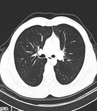 为什么x光片用胶片“云胶片”正式上线啦——用手机随时随地就能看X光片、CT、核磁共振_https://www.jmylbn.com_新闻资讯_第3张