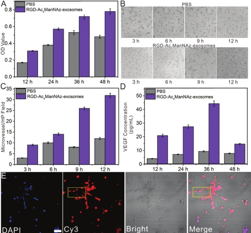 产品应用案例│RGD修饰的外泌体用于增强靶向、协同促进血管新生治疗