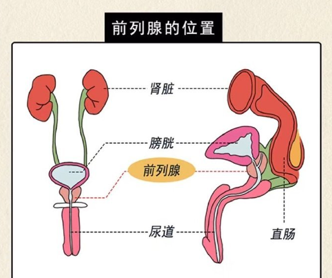 最伤害前列腺的“那些事”，7个字总结！