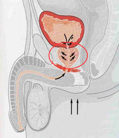纵欲、禁欲，前列腺都在默默躺枪！