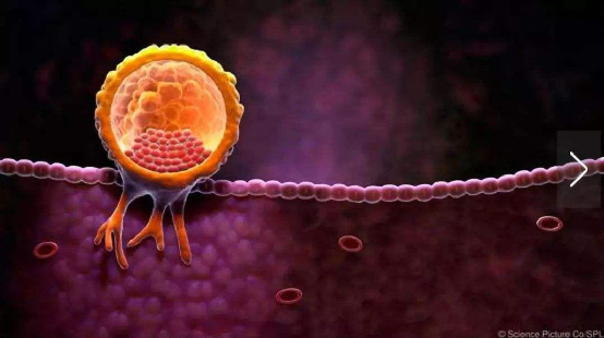 子宫内膜取样怎么取反复移植失败？试试子宫内膜容受性检测，免费哦_https://www.jmylbn.com_新闻资讯_第3张