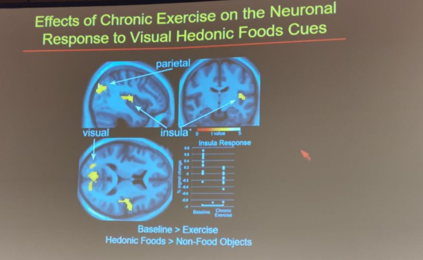 運(yùn)動(dòng)減肥_減肥運(yùn)動(dòng)快速燃脂_減肥運(yùn)動(dòng)的最佳時(shí)間