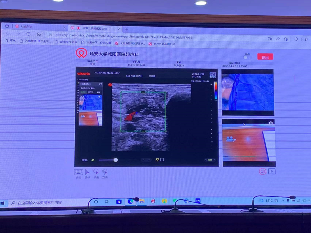 华声医疗 怎么样2022华声前线速递(十四）_https://www.jmylbn.com_新闻资讯_第31张
