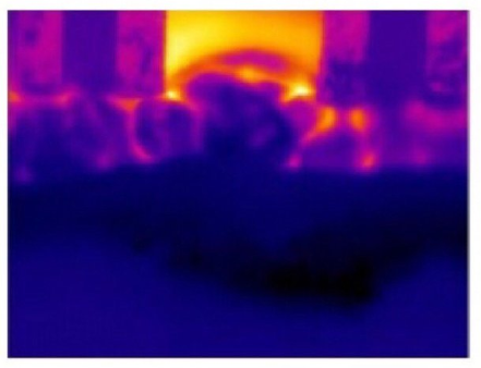 多极射频是什么射频可以改善哪些皮肤问题？医美射频和家用射频盘点_https://www.jmylbn.com_新闻资讯_第7张