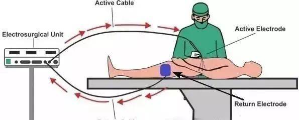 为什么手术用电刀高频电刀——取代机械手术刀的电外科器械_https://www.jmylbn.com_新闻资讯_第6张