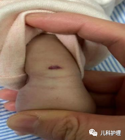 为什么泵输液如何有效预防微量输液泵致婴幼儿输液外渗？_https://www.jmylbn.com_新闻资讯_第3张