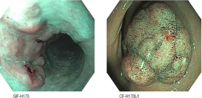内镜清洗工作站是什么胃肠新“镜”界｜洞口县中医医院引进全新奥林巴斯170胃肠镜高配内镜清洗工作站_https://www.jmylbn.com_新闻资讯_第8张