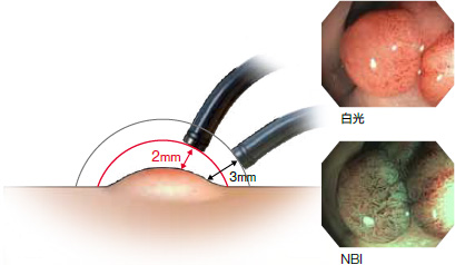 内镜清洗工作站是什么胃肠新“镜”界｜洞口县中医医院引进全新奥林巴斯170胃肠镜高配内镜清洗工作站_https://www.jmylbn.com_新闻资讯_第9张