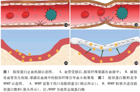 口腔敷料要怎么用医用敷料市场迎来快速发展期，一文汇总骨缺损、牙科、肌腱损伤等敷料领域的最新研究进展_https://www.jmylbn.com_新闻资讯_第10张
