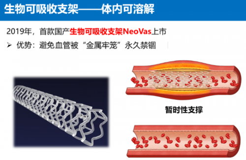 医疗器械用什么材料​PA、PU等高分子材料如何作用于微创介入医疗器械？_https://www.jmylbn.com_新闻资讯_第16张