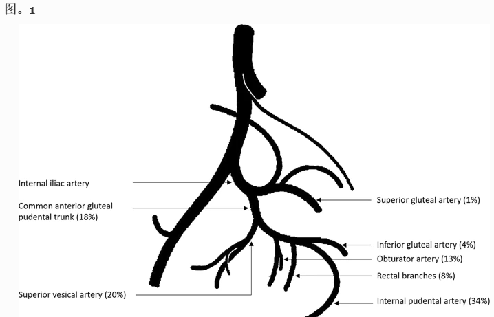 尿动力导管怎么好贵CIRSE 前列腺动脉栓塞术实践标准_https://www.jmylbn.com_新闻资讯_第3张