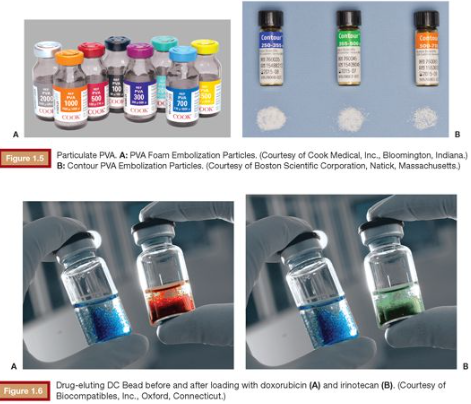 栓塞器材指的哪些栓塞剂简史和分类_https://www.jmylbn.com_新闻资讯_第7张