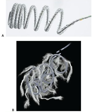 栓塞器材指的哪些栓塞剂简史和分类_https://www.jmylbn.com_新闻资讯_第5张