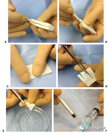 明胶在血管怎么降解明胶海绵的制备_https://www.jmylbn.com_新闻资讯_第2张