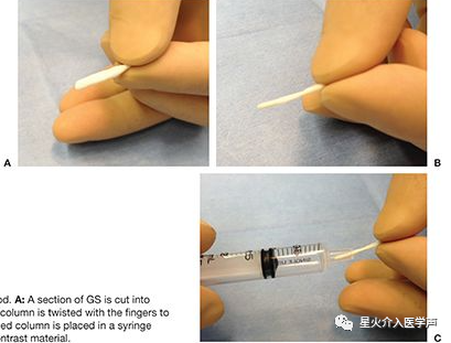 明胶在血管怎么降解明胶海绵的制备_https://www.jmylbn.com_新闻资讯_第4张