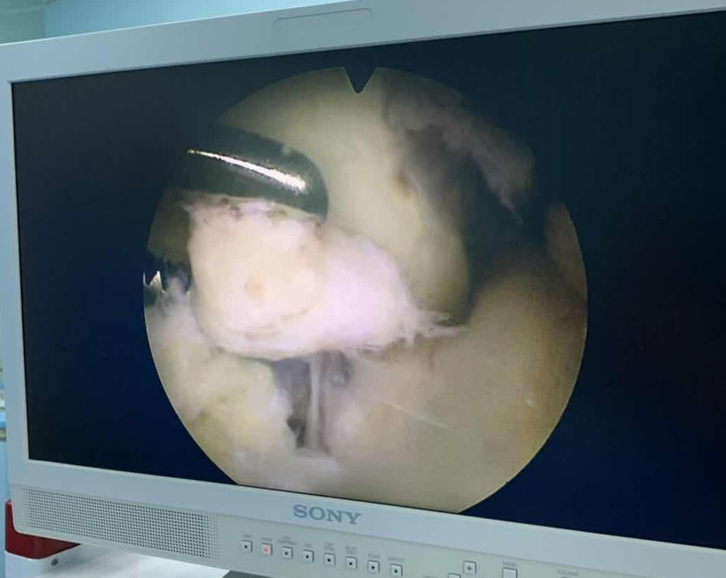 骨科有什么设备【先进设备.骨外科】关节镜_https://www.jmylbn.com_新闻资讯_第3张
