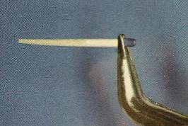 手把手教你纤维桩修复的精细化操作